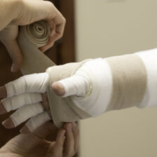 Person with whole arm and fingers bandaged
