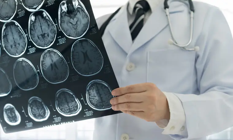 Brain scans